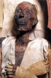The unwrapped mummy of the Egyptian Pharaoh Ramasses